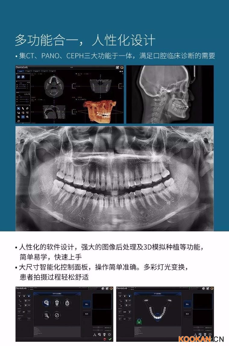 菲森CBCT多功能合一，人性化設計