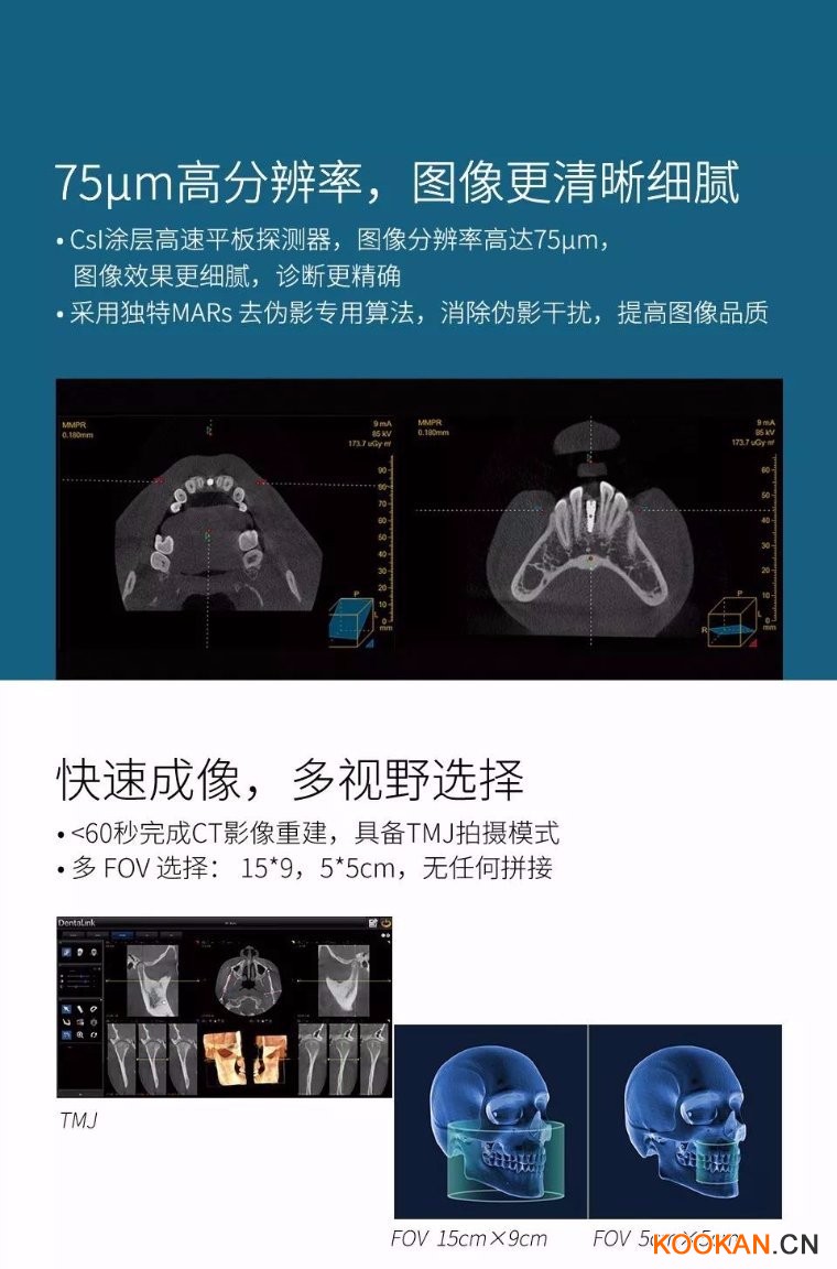 菲森CBCT拍攝影像圖像清晰細膩