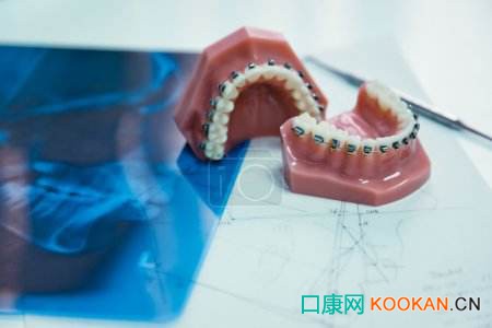 口腔行業開啟千億級市場，正畸醫生緊缺
